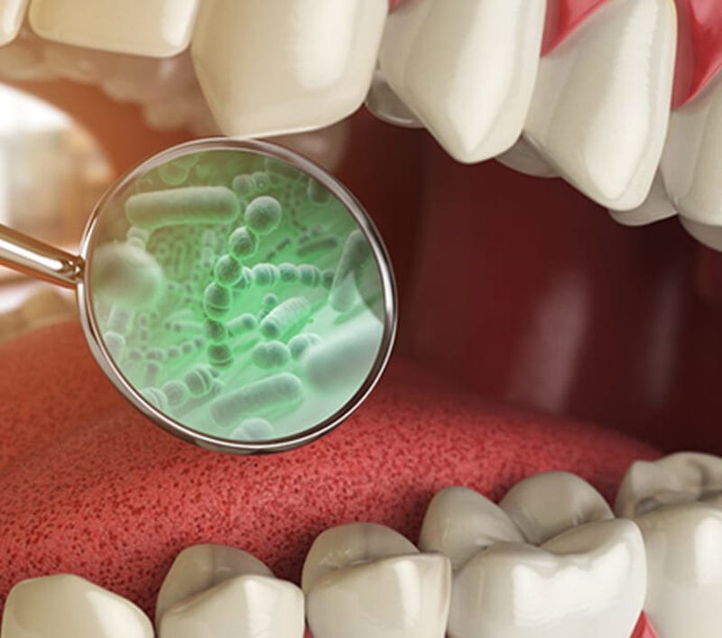 Bacteria on teeth