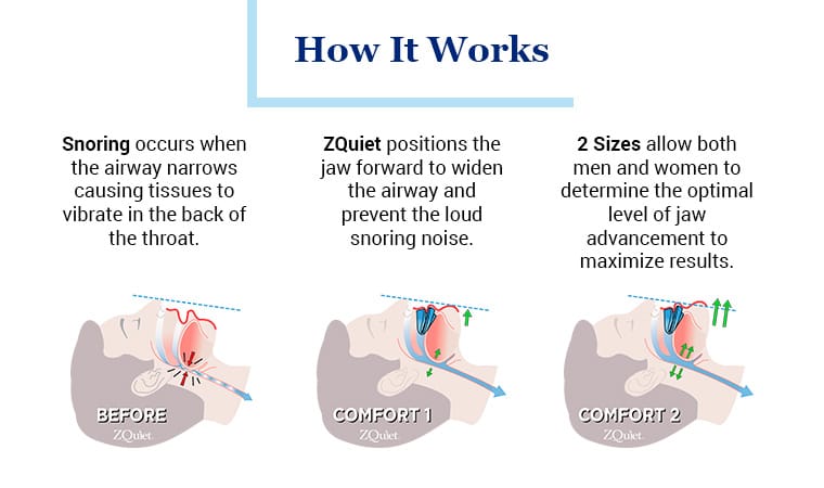 A diagram showing how zquiet works for those who study sleep