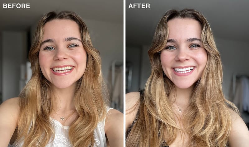 Before and after of a woman with white teeth after using Laughland teeth whitening
