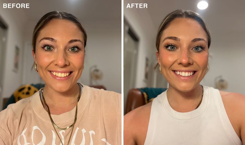 Before and after of a woman with white teeth after using Laughland teeth whitening