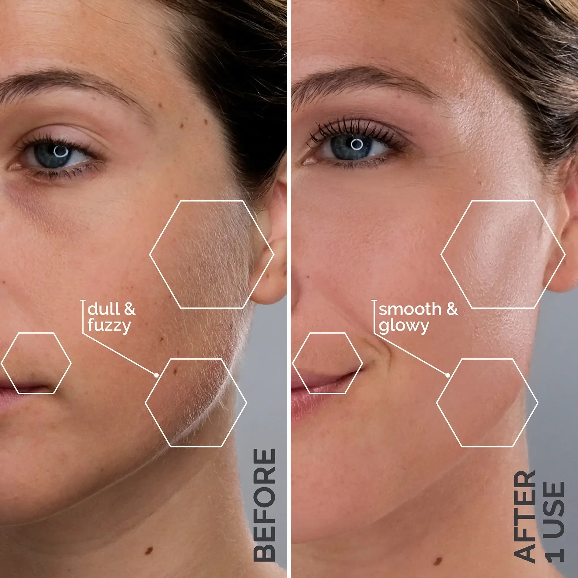 6 Reasons Women over 50 Need This Dermaplaning System