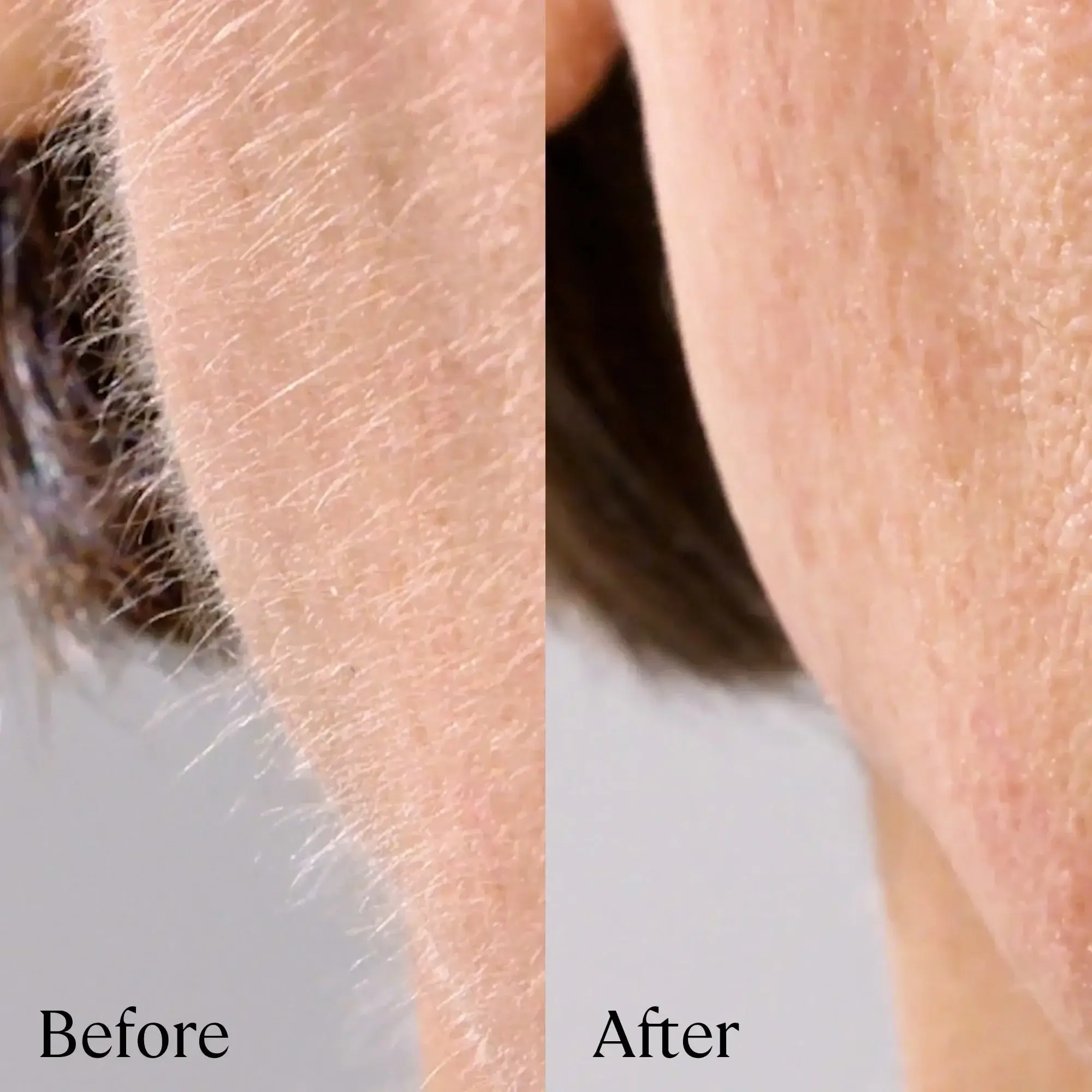 6 Reasons Women over 50 Need This Dermaplaning System